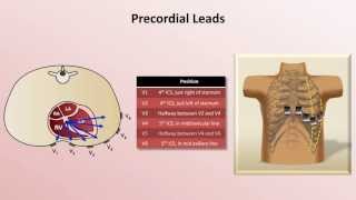 Intro to EKG Interpretation  EKG Leads [upl. by Ellennahc934]