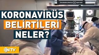 Koronavirüsün Gün Gün Belirtileri  NTV [upl. by Harod]