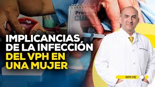 ¿La infección del virus de papiloma humano significa riesgo de cáncer ROTATIVARPP  SEGMENTO [upl. by Kcirddec911]