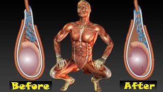 Varicocele exercise for men [upl. by Ettessil]