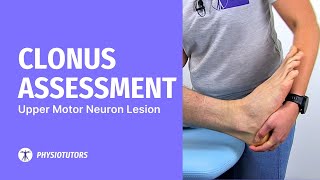 Clonus Assessment  Upper Motor Neuron Lesion [upl. by Jerrilyn]