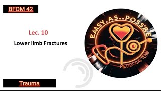 Lecture 10  Lower Limb Fractures  Trauma 42 [upl. by Adelbert]