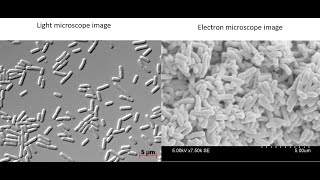 What do bacteria look like under a light vs electron microscope [upl. by Negeam834]