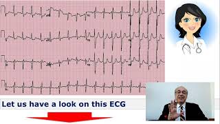 EKG Trainer Case 10 Questions [upl. by Ziza136]