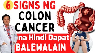 6 Signs ng Colon Cancer na Hindi Dapat Balewalain  Payo ni Doc Willie Ong [upl. by Ecyoj]