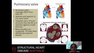 Pulmonary valve pathology and echocardiographic assessment  Dr Liza Thomas [upl. by Roze]