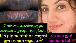 കരികട്ട ചുണ്ടും ചുമക്കാൻ ഒരു ദിവസം മതി 💯live result lipcarelippigmentation [upl. by Yetnom]