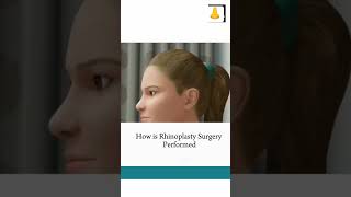 Rhinoplasty surgery In animation neetstudy2024motivationviralvideosuccessmotivation shortvideo [upl. by Mehsah]