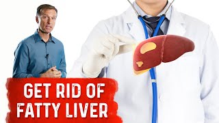 Reduce Your Liver Fat by 50 Percent in 14 Days [upl. by Johnsson]