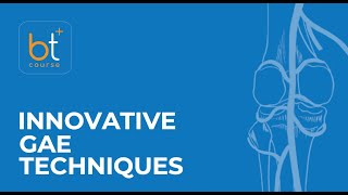 Course Preview Innovative Genicular Artery Embolization Techniques Two Case Studies [upl. by Lyrrad]