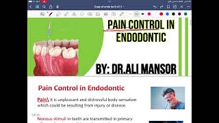 endodontics pain control lec3  stage5 [upl. by Notsob]