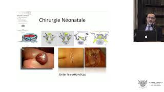 Le traitement chirurgical prénatal endoscopique du myéloméningocèle [upl. by Patrizio425]