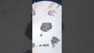 Detergent Dissolving in Water Under the Microscope Tiny Bubbles and Reactions [upl. by Nylyak]