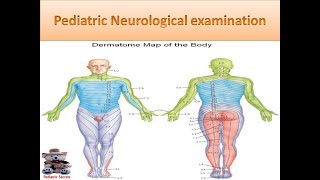 Pediatric Neurological examination [upl. by Close]