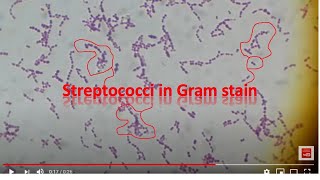 Streptococcus agalactiae [upl. by Gnik370]