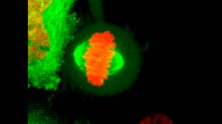 Mitosis in 2D  HeLa cell undergoes mitosis [upl. by Christalle407]