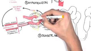 Chronic Kidney Disease CKD Pathophysiology [upl. by Christan]