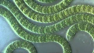 Cyanobacteria under microscope [upl. by Gherardo46]