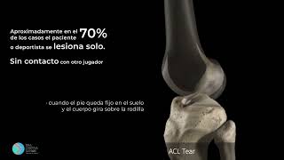 LESION DEL LIGAMENTO CRUZADO ANTERIOR [upl. by Ymorej]