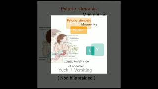 🦅 PYLORIC STENOSIS Mnemonic 🕊 [upl. by Tal]