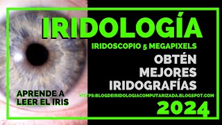 🔥🔥 MEJOR IRIDOSCOPIO 2024 PARA EXAMINAR UN IRIS [upl. by Aerdna236]