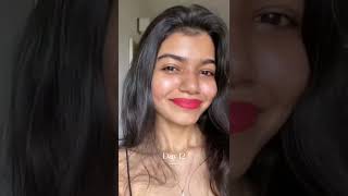 My Accutane Isotretinoin Journey amp Kbeauty isotretinoin kbeauty indianskincare [upl. by Anyalram]