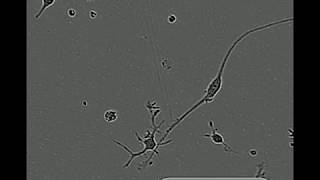 Cell Motility of Microglia Cultured in TIC [upl. by Sivrat]