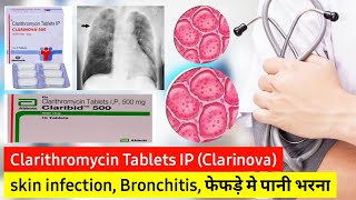 Clarithromycin 500 mg what is it used for hindi  Treatment of Pneumonia and Lungs infection [upl. by Artekal14]