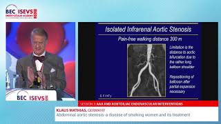 BEC 2021  Abdominal aortic stenosis – a disease of smoking women and its treatment  Klaus Mathias [upl. by Raul256]