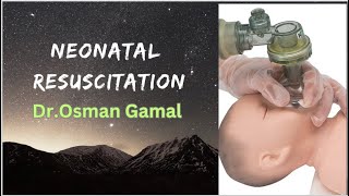 Neonatal Resuscitation  for NICU physicians [upl. by Anait]