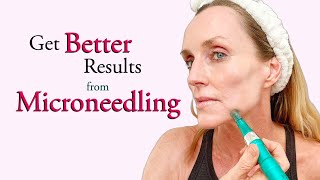 A BETTER way to Microneedle Full Demo amp The Difference between Cosmetic amp Medical Microneedling [upl. by Eednar]