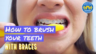 How to Brush with Braces  3 Brushing Tips [upl. by Hametaf520]