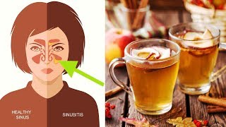 5 Ways to Use Apple Cider Vinegar For Sinus Infection [upl. by Klehm]