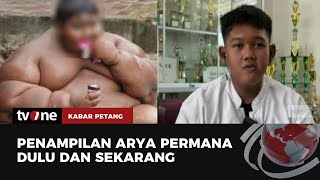 Masih Ingat Arya Bocah Obesitas Begini Sekarang Kondisinya  Kabar Petang tvOne [upl. by Anirtal]