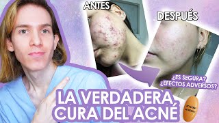 ROACCUTAN o ACCUTANE Efectos adversos como tomarla antes y despues LA VERDAD de la ISOTRETINOINA [upl. by Anaet783]