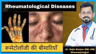 रूमेटोलॉजी की बीमारिया  Common Rheumatological Diseases [upl. by Uohk]