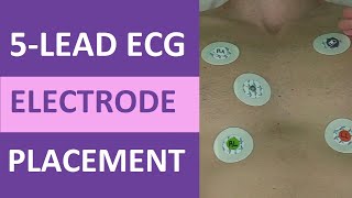 5 Lead ECG Placement of Electrodes EKG NCLEX amp Nursing Mnemonic [upl. by Girardi]