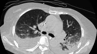 BOOP Ahuja AT et al 2017 Book Essential Radiology [upl. by Oluap]