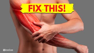 How to Fix Arm Muscle Pain in 30 SECONDS [upl. by Verdie]