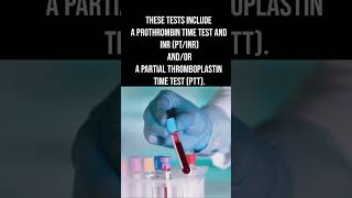 Sodium citrate tube uses coagulation test PTINR PTT test medical coagulation medicalshortsx [upl. by Nnep]