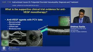 5 Treatment PCV AntiVEGF Monotherapy PLANET HAWK HARRIER [upl. by Rebmaed]