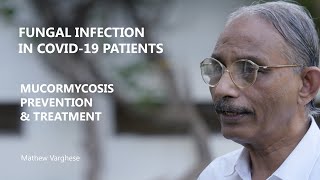 Black Fungus in Covid19 patients I Mucormycosis I Warning Signs amp Treatment I Dr Mathew Varghese [upl. by Aicssej604]