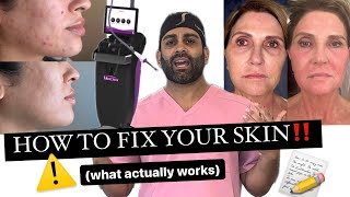 Do Laser Treatments Work how to get rid of acne scars texture amp sun damage [upl. by Richy]