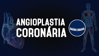 ANGIOPLASTIA CORONÁRIA  SÉRIE SAÚDE BRASIL [upl. by Yates]