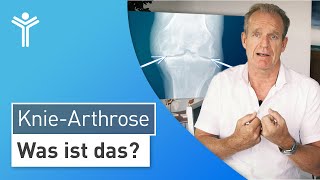 KnieArthrose Was ist die Arthrose des Kniegelenks und wie kommt es zum Gelenkverschleiß [upl. by Milah564]