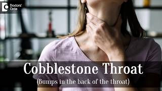 What is cobblestone throat  DrHarihara Murthy [upl. by Eetsirk]