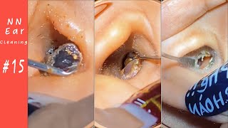 Impacted Ear Wax RemovalEP15  NN Ear cleaning [upl. by Pastelki]