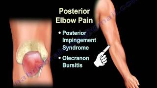 ELBOW PAIN  COMMON CAUSES  Everything You Need To Know  Dr Nabil Ebraheim [upl. by Arreyt]