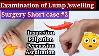 examination of lump swelling Surgery Short case 2 inspection Palpation Percussion Ascultation [upl. by Natika]