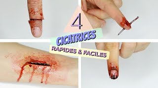 TUTO 4 Cicatrices Rapides et Faciles à faire [upl. by Ymaral383]